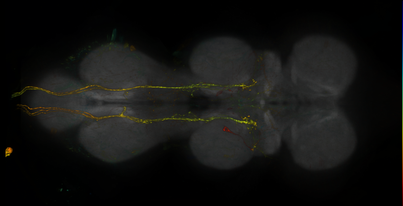 P{GMR73A05-lexA} expression pattern
