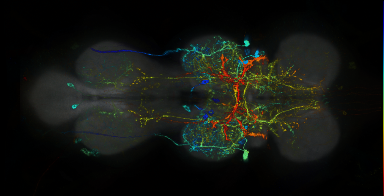 P{GMR75C10-lexA} expression pattern