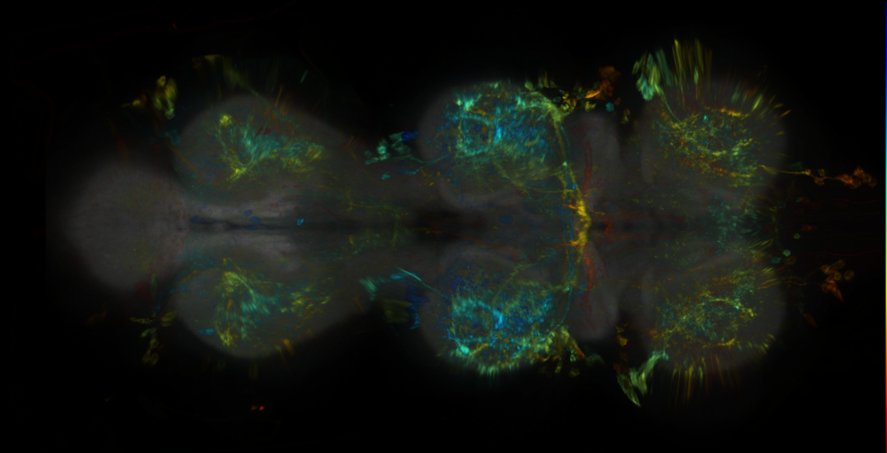 P{GMR77D07-lexA} expression pattern
