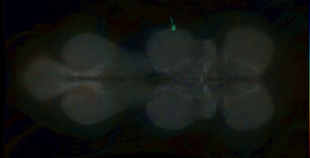 P{GMR78H08-lexA} expression pattern