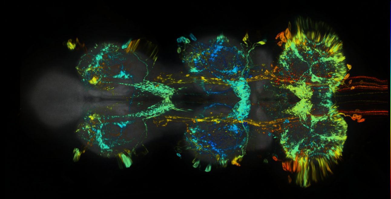 P{GMR79H04-lexA} expression pattern