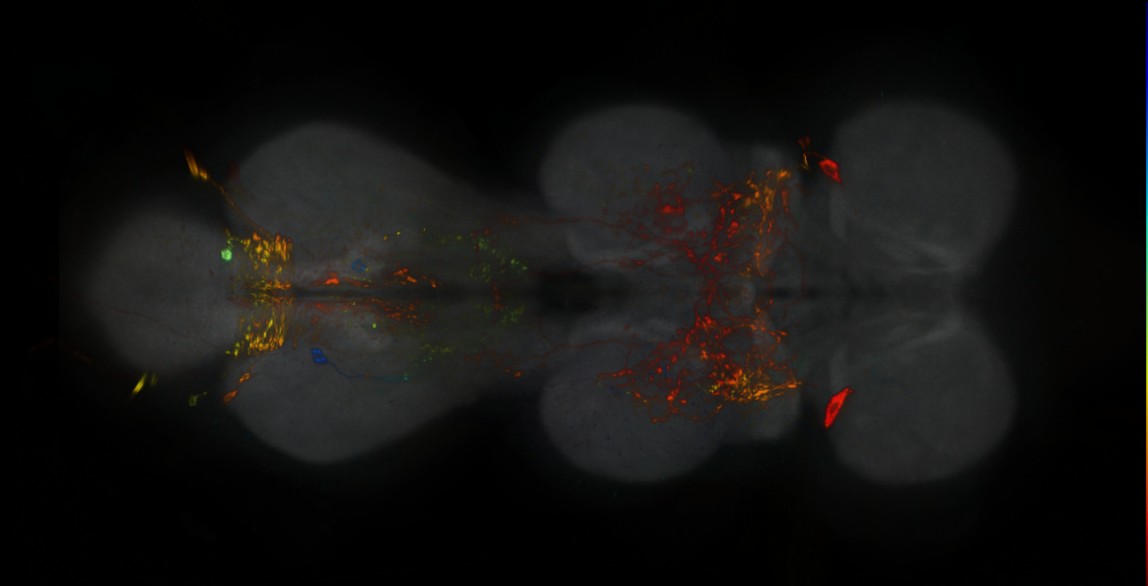 P{GMR81E06-lexA} expression pattern
