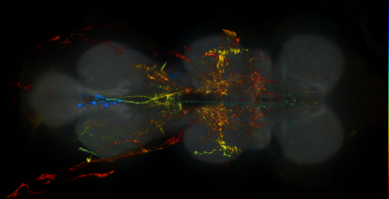 P{GMR81E11-lexA} expression pattern