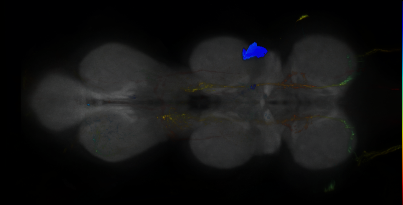 P{GMR85E11-lexA} expression pattern