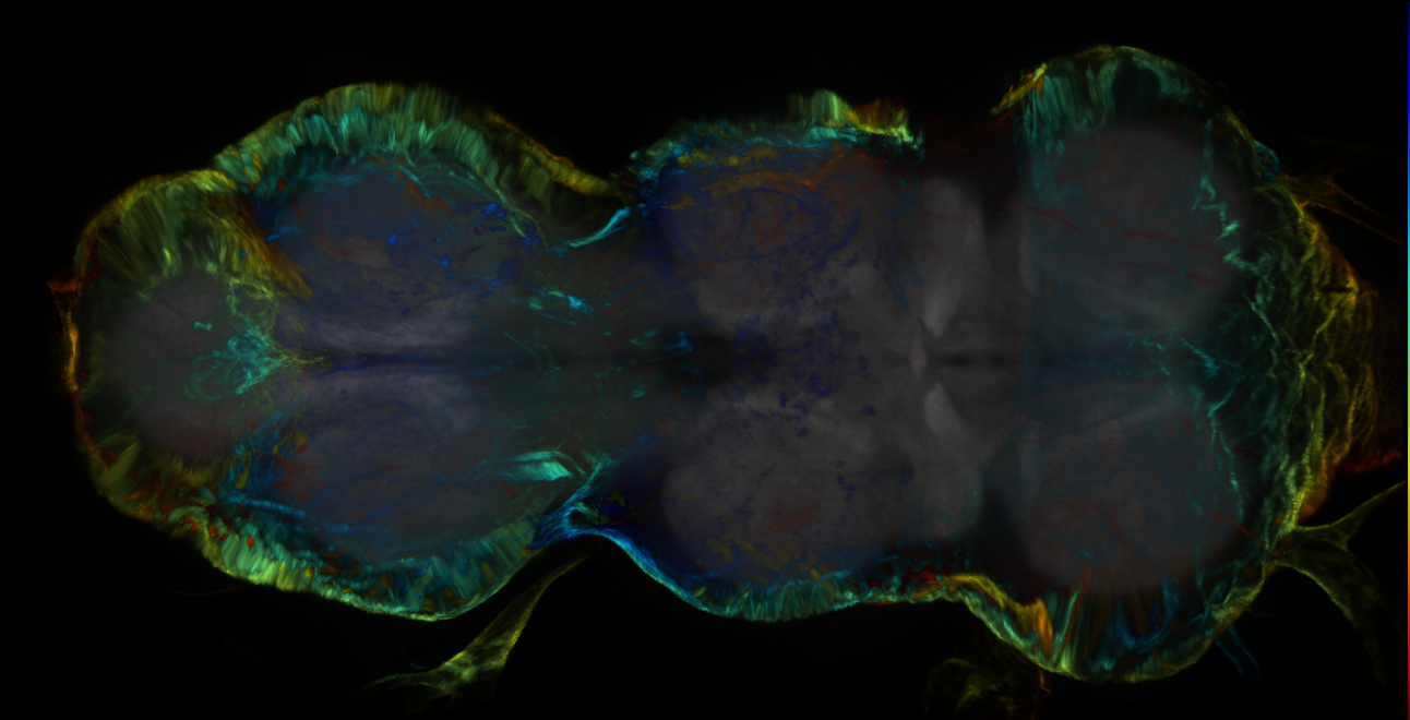 P{GMR85G01-lexA} expression pattern