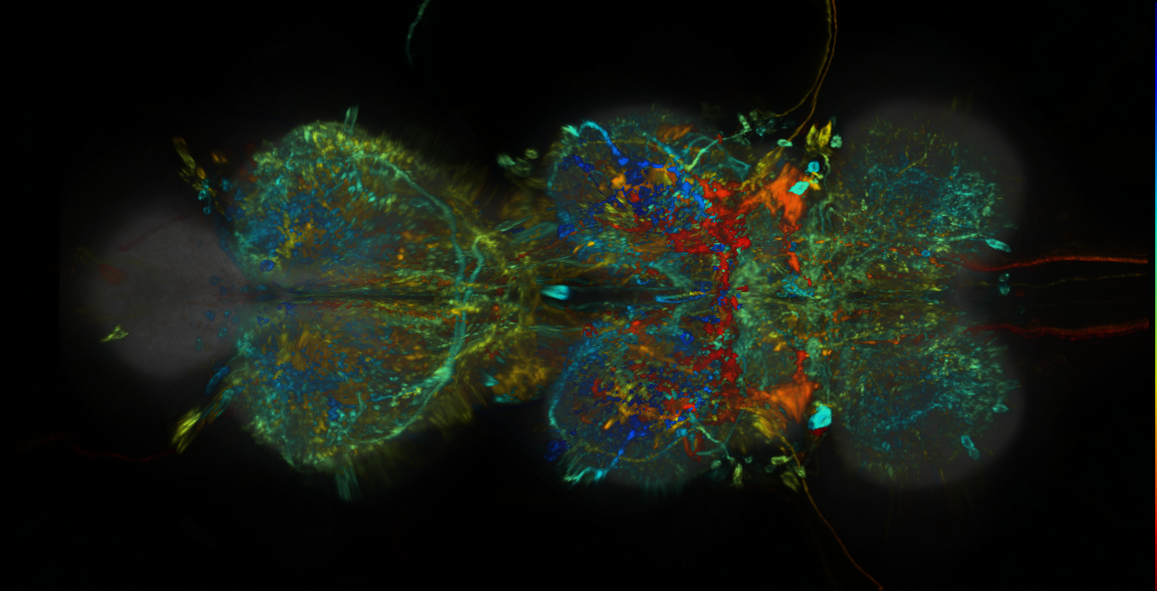 P{GMR85H03-lexA} expression pattern