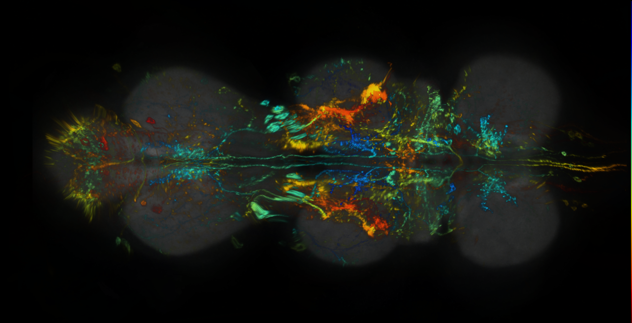 P{GMR92B01-lexA} expression pattern