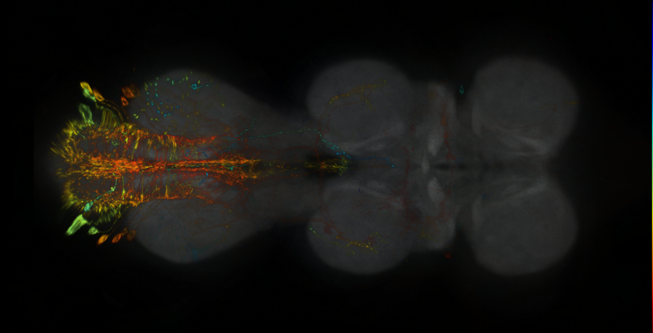 P{GMR92B11-lexA} expression pattern