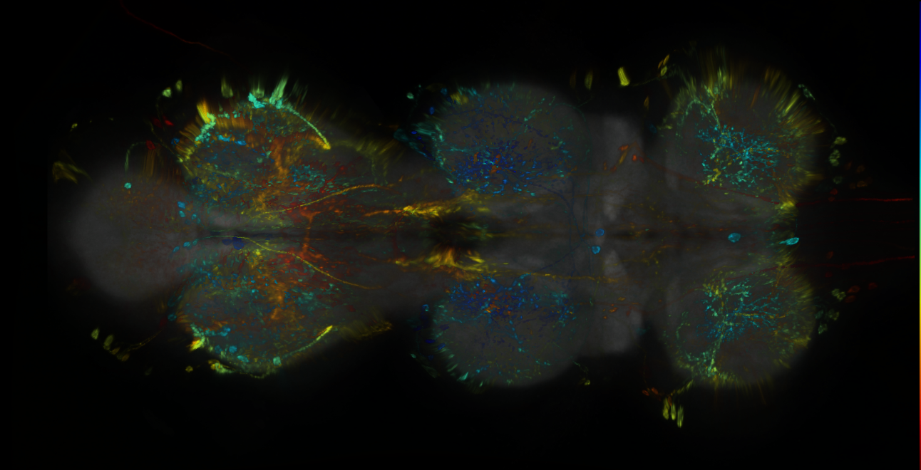 P{GMR94F11-lexA} expression pattern
