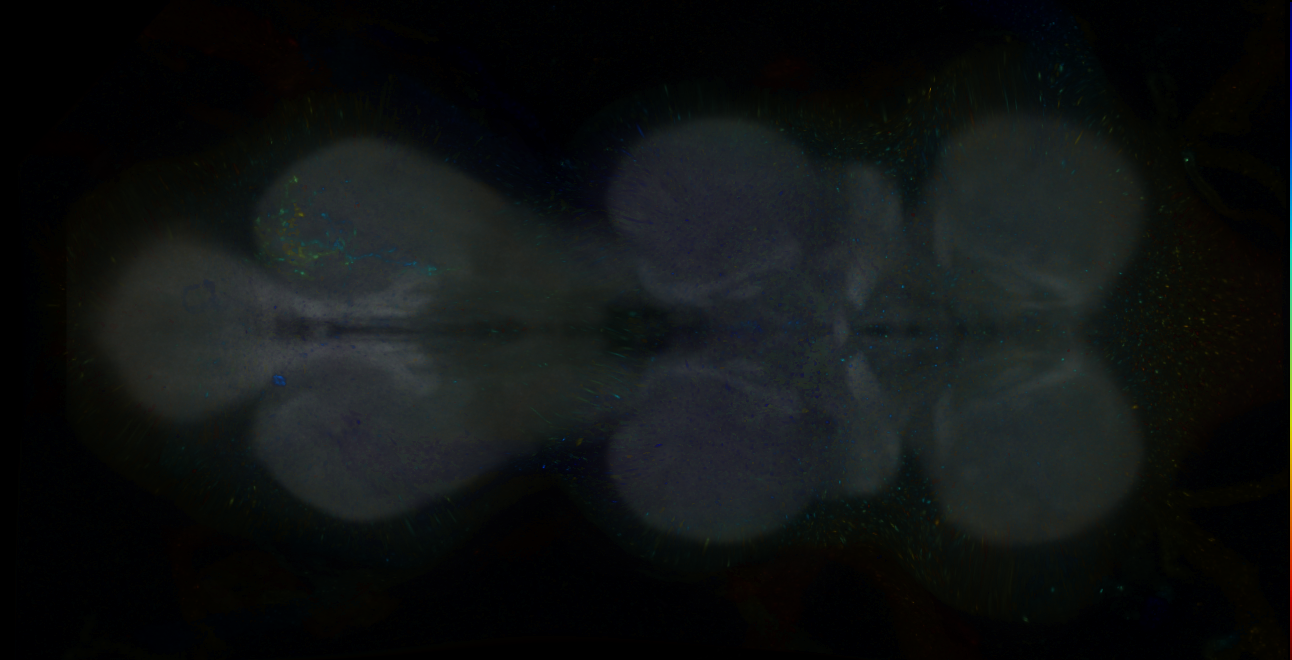 P{GMR95A10-lexA} expression pattern