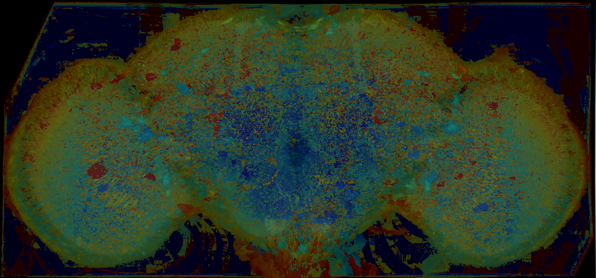 P{GMR11H07-lexA} expression pattern