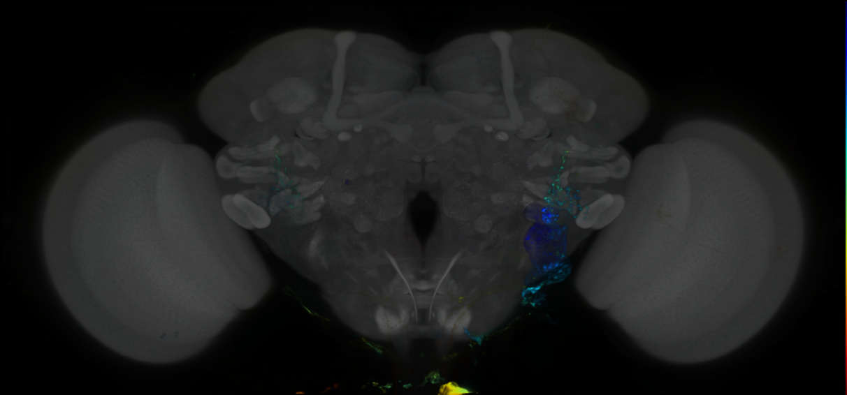 P{GMR20E02-lexA} expression pattern