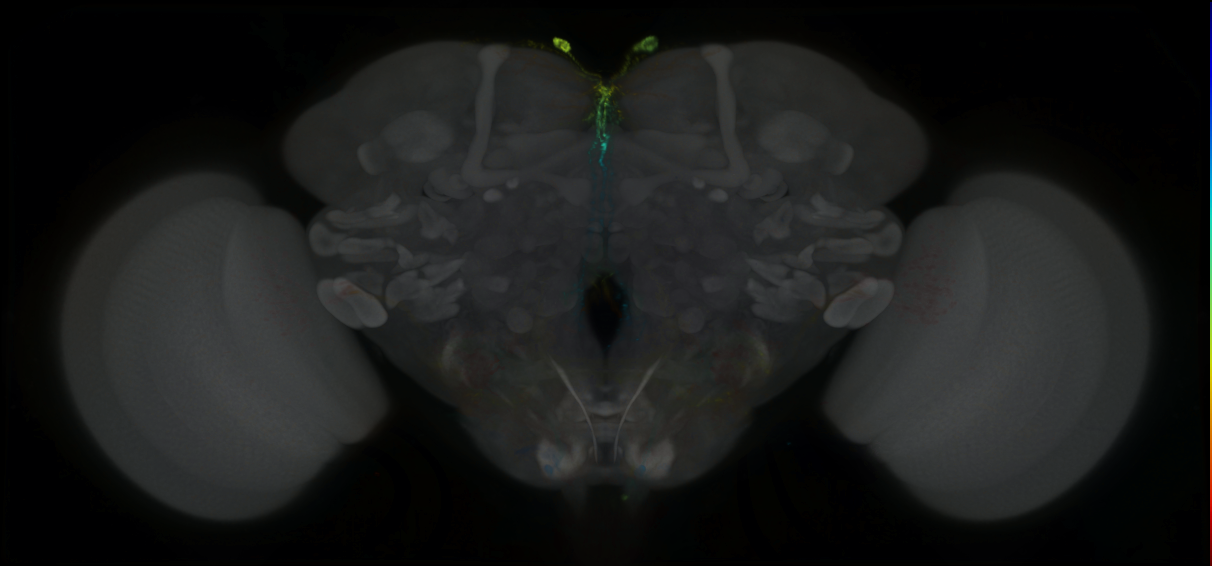 P{GMR22D11-lexA} expression pattern