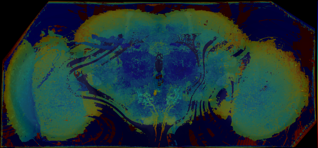 P{GMR69C07-lexA} expression pattern