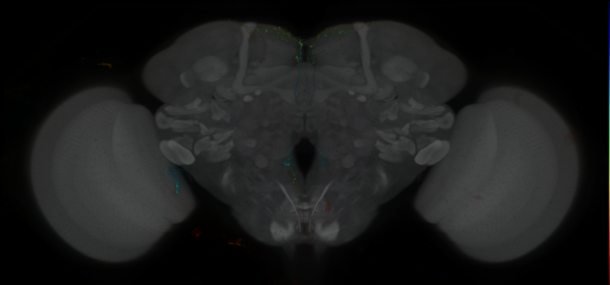 P{GMR69H10-lexA} expression pattern