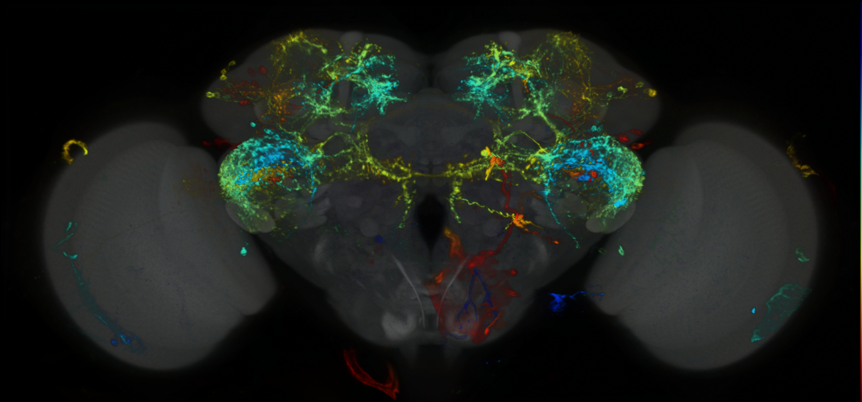 P{GMR81E11-lexA} expression pattern