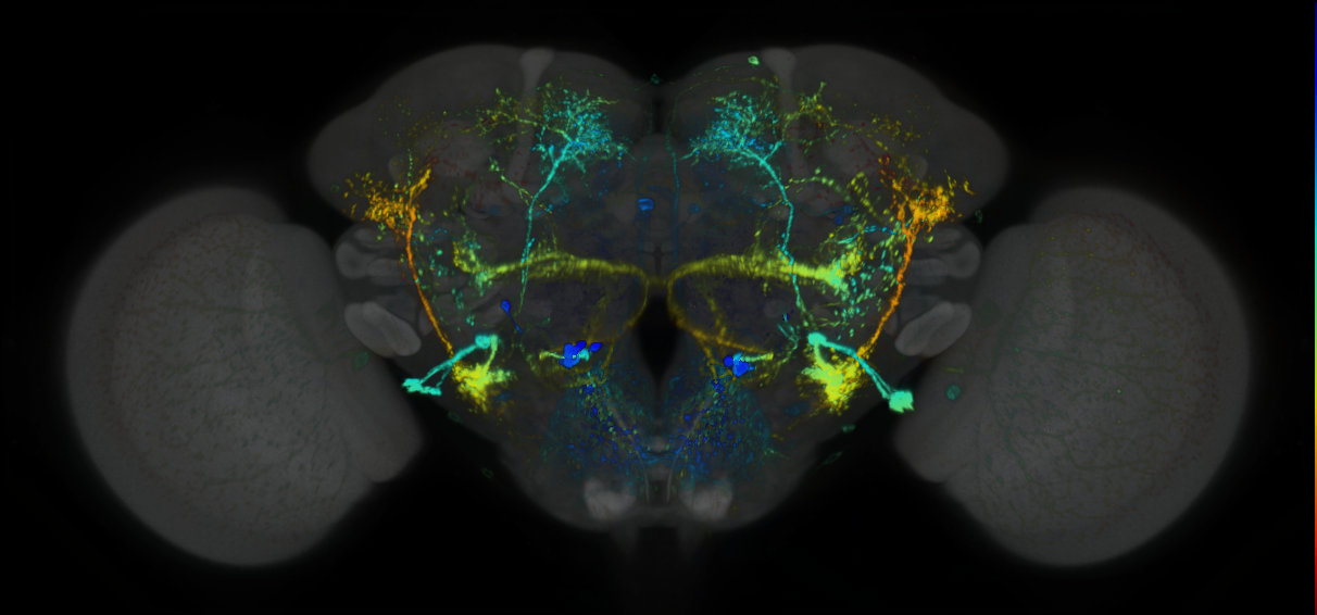 P{GMR92B01-lexA} expression pattern