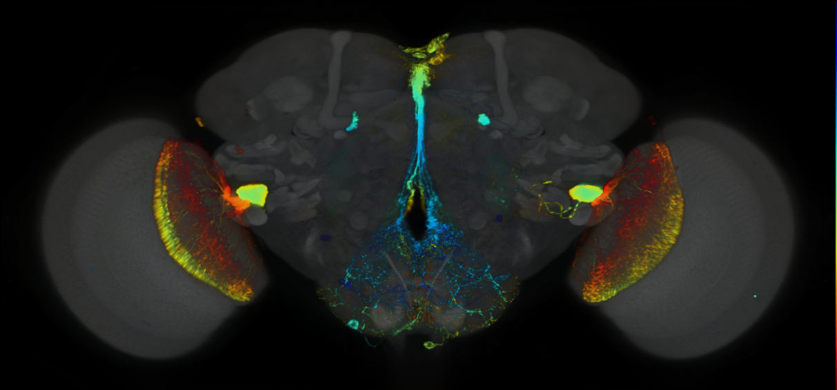 P{GMR92B11-lexA} expression pattern