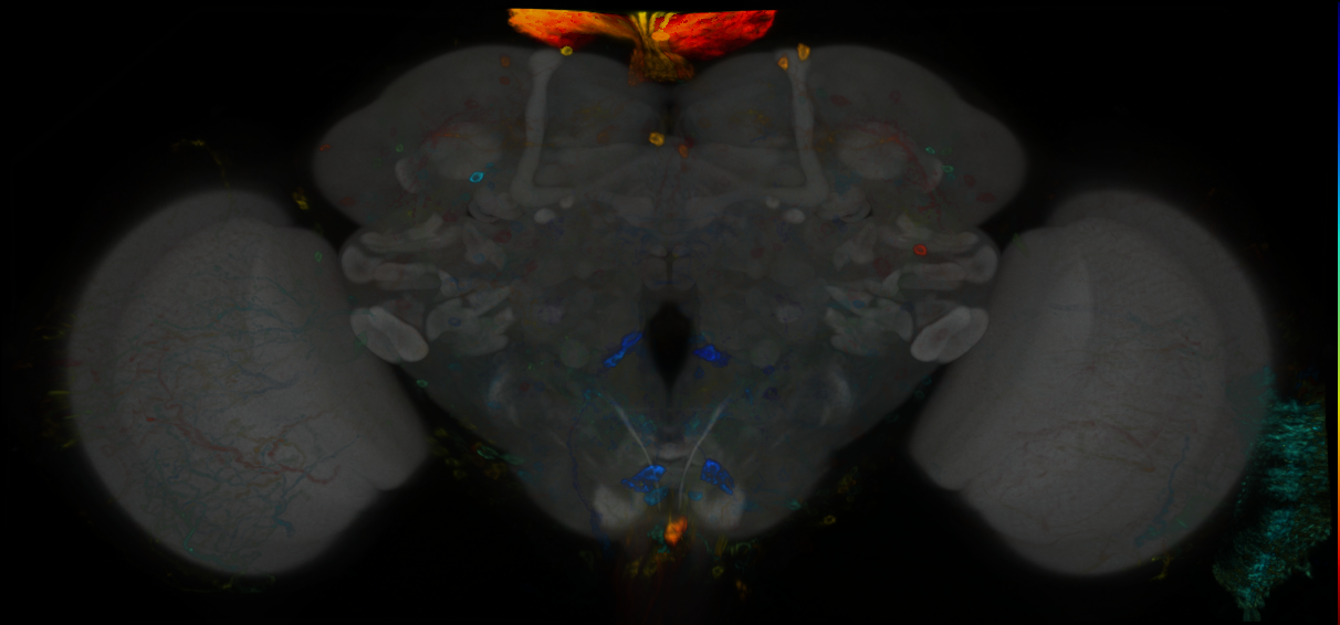 P{GMR14D03-GAL4} expression pattern