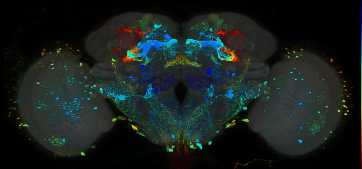 P{GMR17A06-GAL4} expression pattern