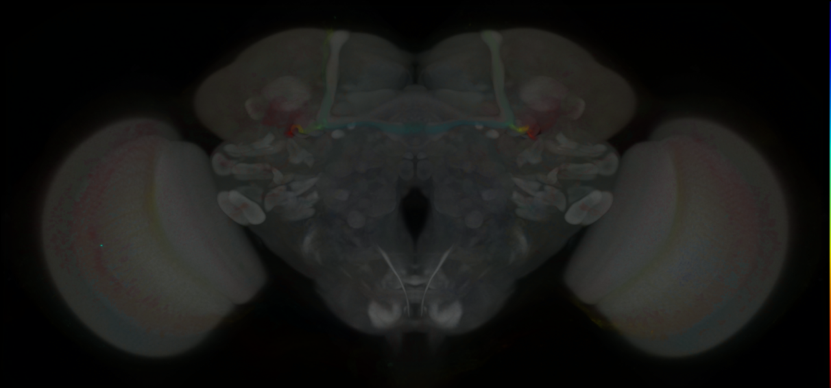 P{GMR17B05-GAL4} expression pattern