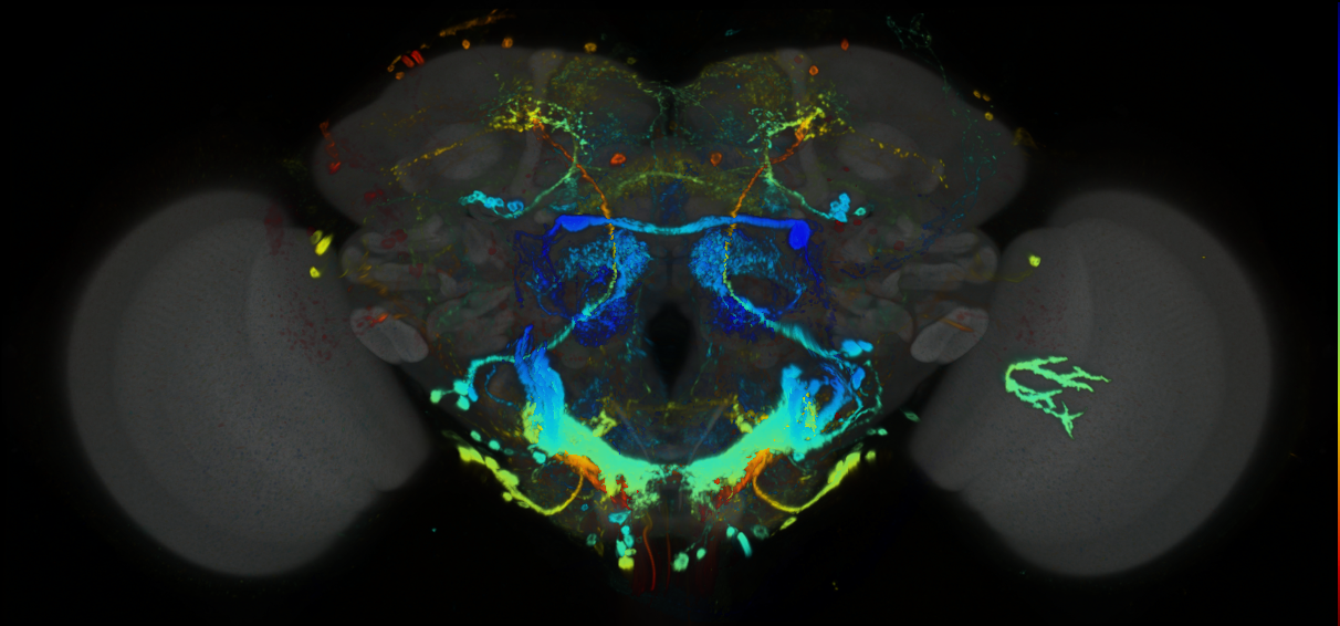 P{GMR18E06-GAL4} expression pattern