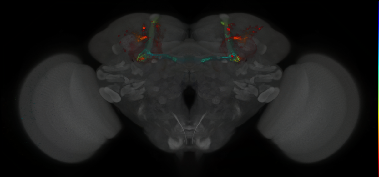 P{GMR20A05-GAL4} expression pattern