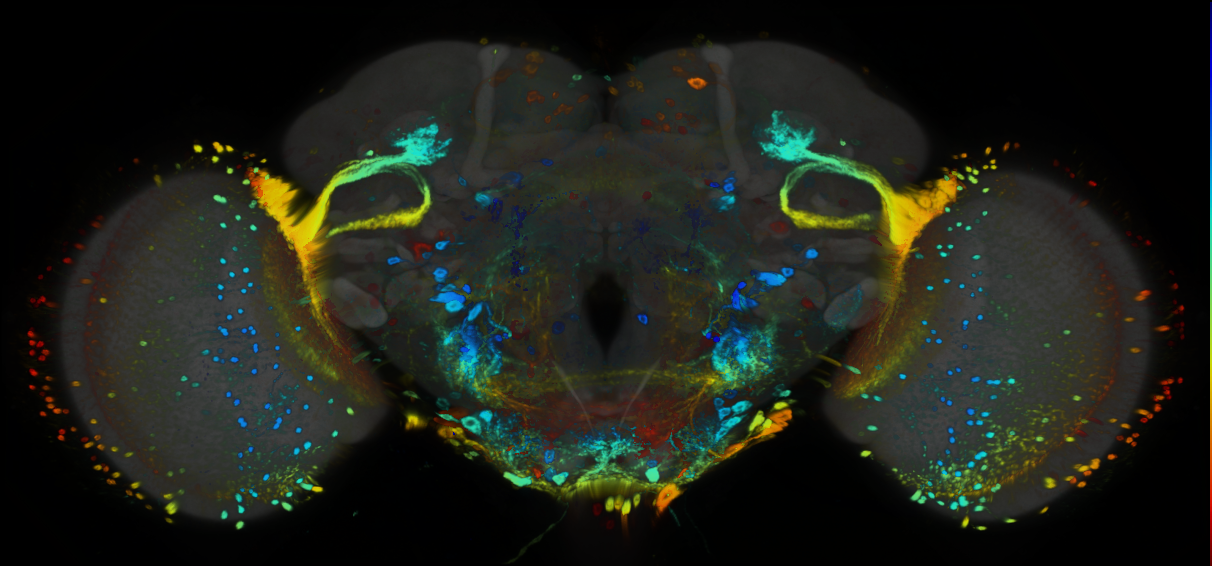 P{GMR22A07-GAL4} expression pattern