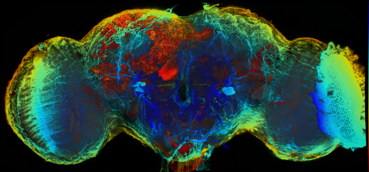 P{GMR22D05-GAL4} expression pattern