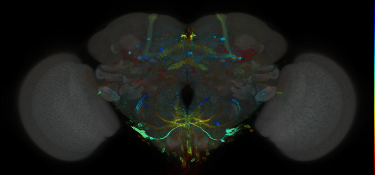 P{GMR31F06-GAL4} expression pattern