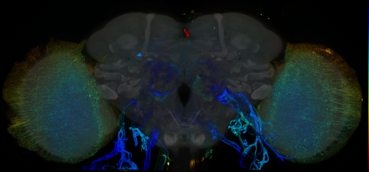 P{GMR31F07-GAL4} expression pattern