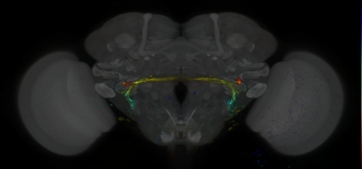 P{GMR32C04-GAL4} expression pattern