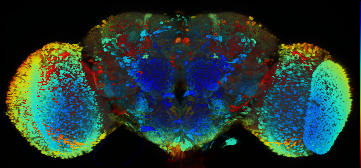 P{GMR54E04-GAL4} expression pattern
