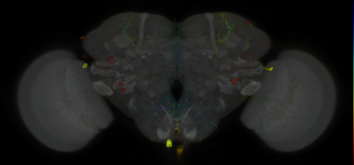 P{GMR55A10-GAL4} expression pattern
