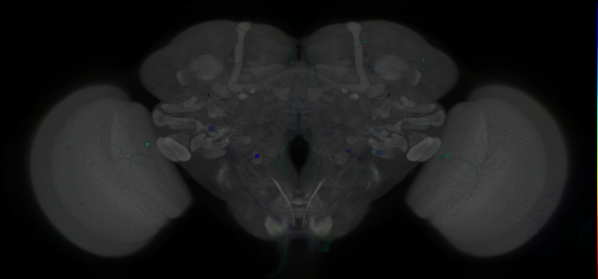 P{GMR64A06-GAL4} expression pattern