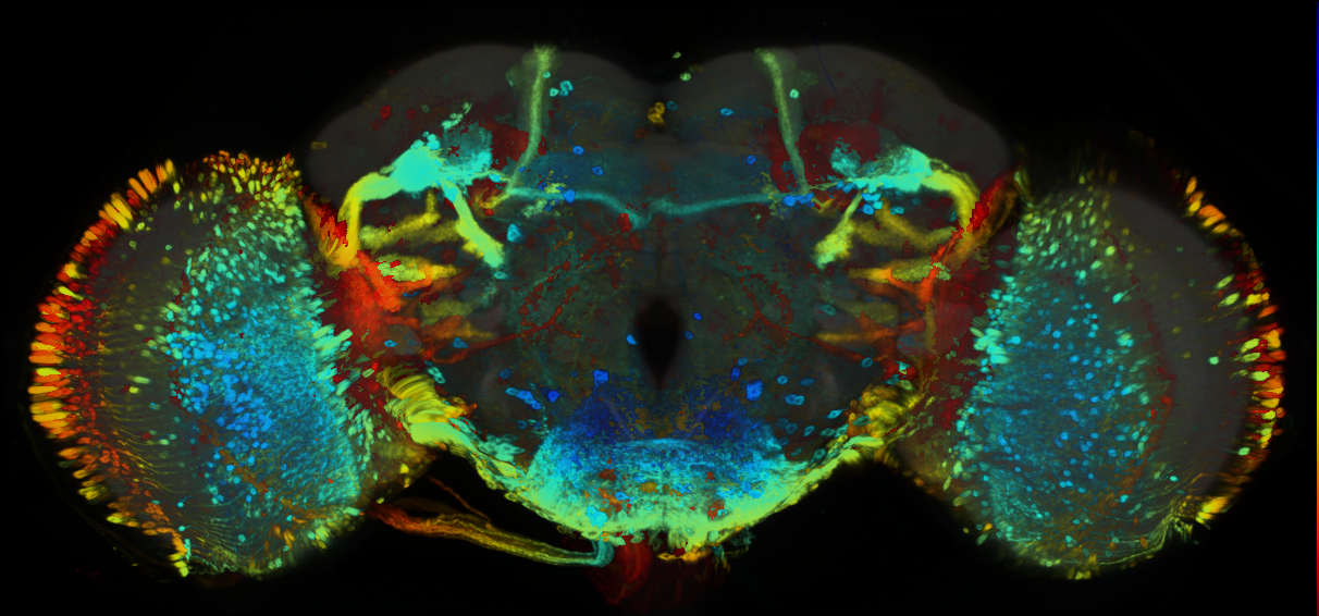 P{GMR64F11-GAL4} expression pattern