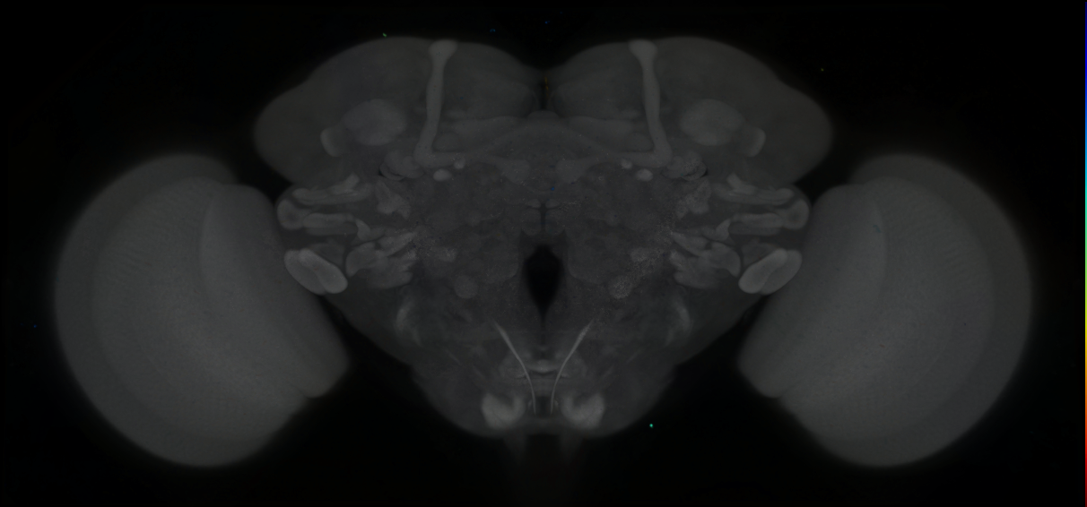 P{GMR69D04-GAL4} expression pattern