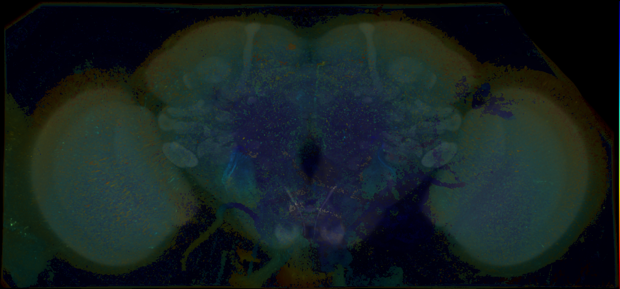 P{GMR69E07-GAL4} expression pattern