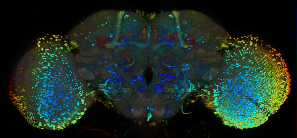 P{GMR70H10-GAL4} expression pattern