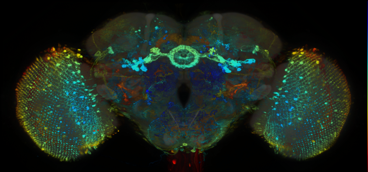 P{GMR75E02-GAL4} expression pattern