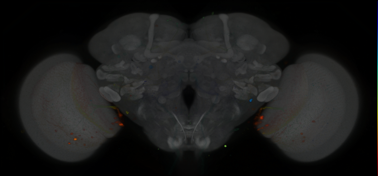P{GMR75E11-GAL4} expression pattern