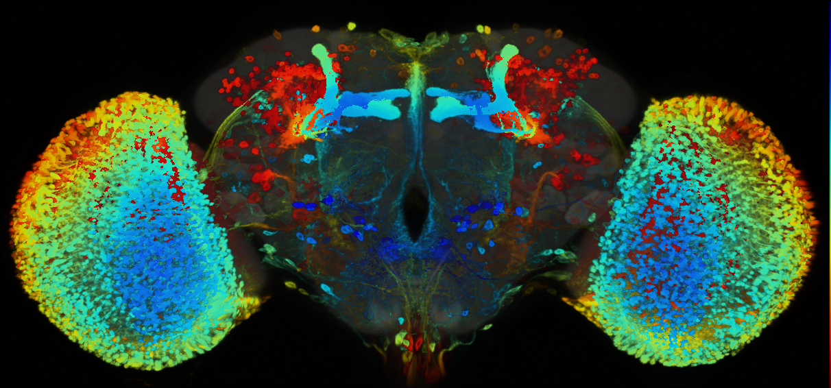 P{GMR76B04-GAL4} expression pattern