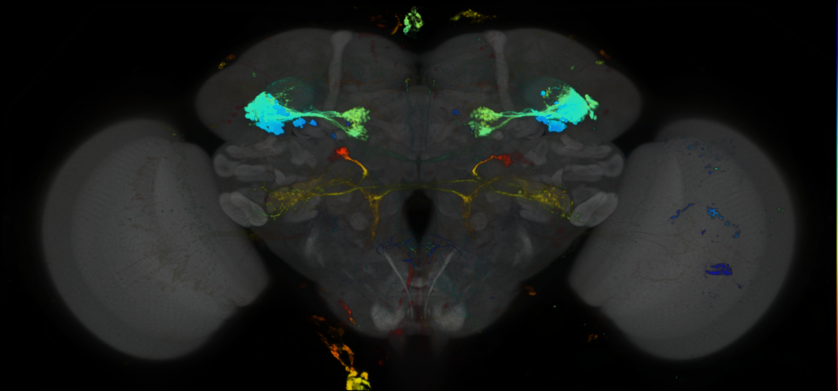 P{GMR76B06-GAL4} expression pattern