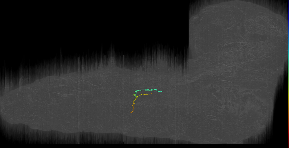 SN motor neuron a1l bilateral (L1EM:4483081)