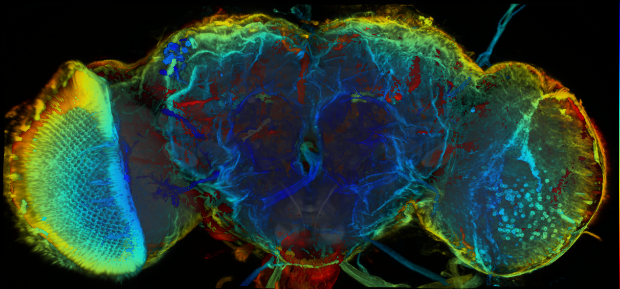 P{GMR77G08-GAL4} expression pattern