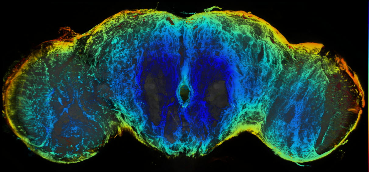 P{GMR79H11-GAL4} expression pattern