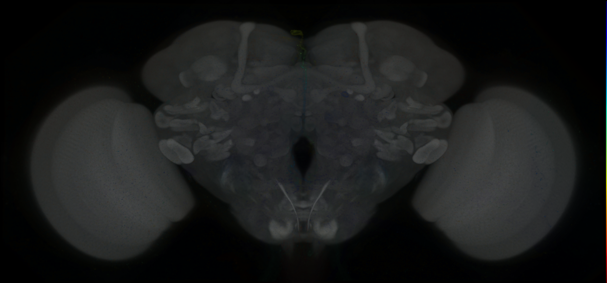 P{GMR82B06-GAL4} expression pattern