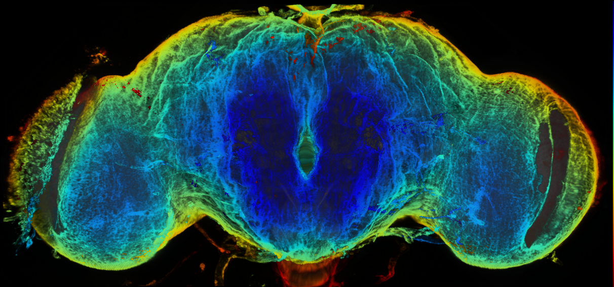 P{GMR84C08-GAL4} expression pattern