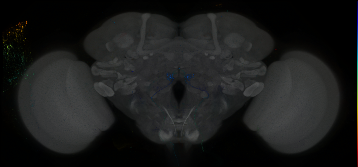 P{GMR87F09-GAL4} expression pattern