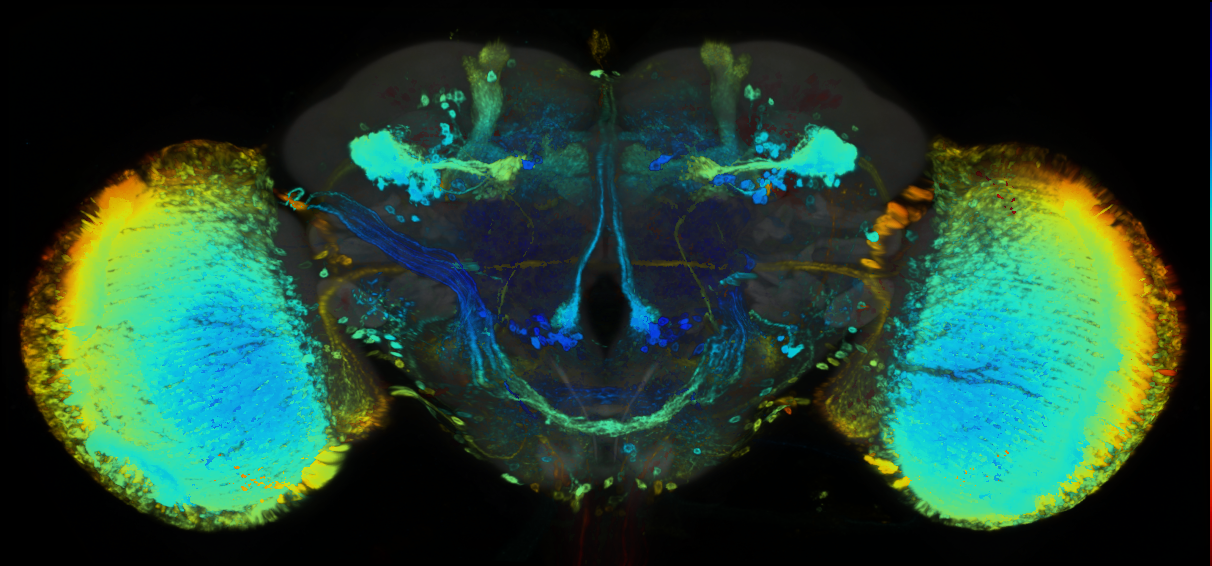 P{GMR93B04-GAL4} expression pattern